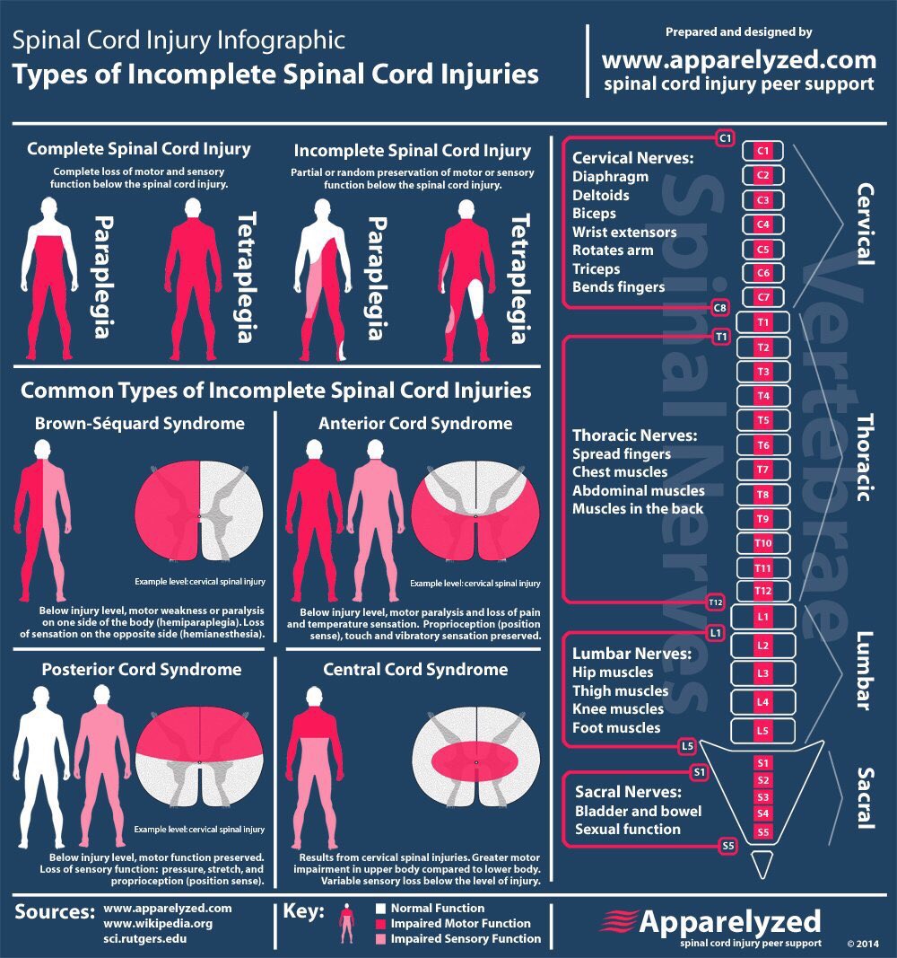 Types of Spinal Cord Injuries