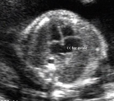 <p><span style="line-height: 21.6px;"><strong>Evaluate fetal situs</strong>; what is the presentation of the image?</span></p>