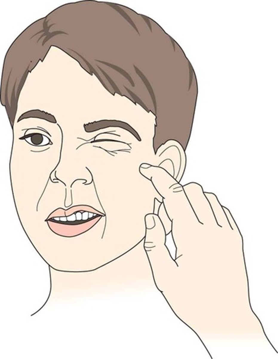 <p>Cheek, facial spasm when Cheek is tapped associates with hypocalcemia</p>