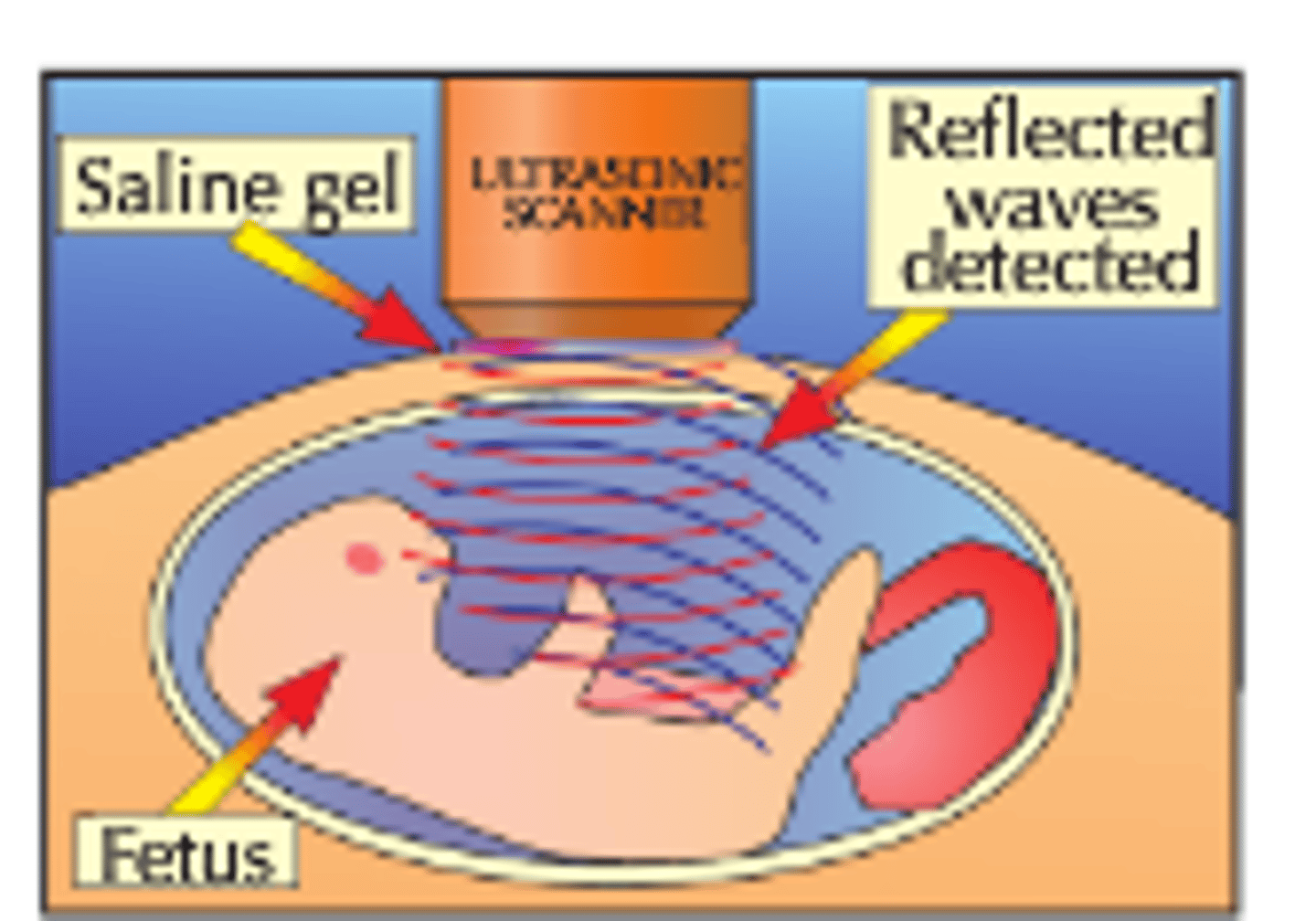 <p>The waves are partially reflected when they meet a boundary between two materials and the time taken for the reflected waves to reach a detector can be used to determine how far away the boundary is</p>