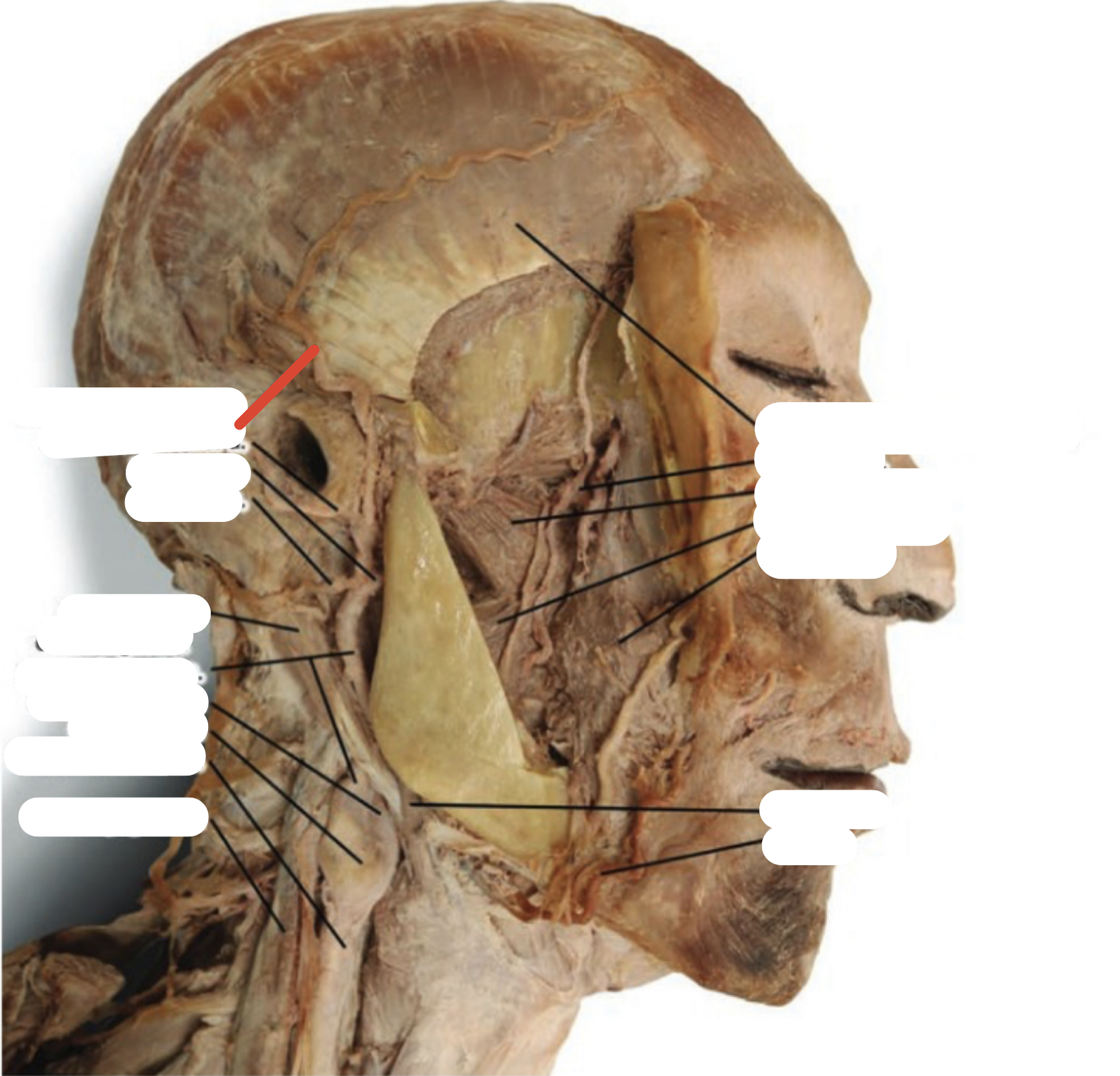 Identify the structure (red line)