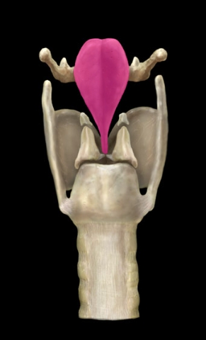 term image