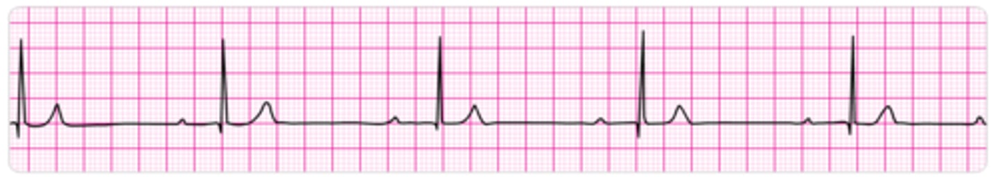 <p>sự tiến bộ</p>