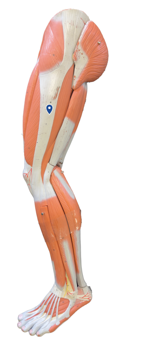 <p>What muscle is the arrow pointing to?</p>