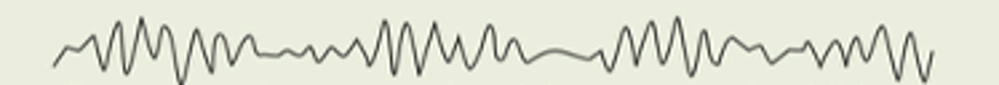 <p>- 4 to 7 Hz</p><p>- Found normally in children or in intensely frustrated, stressed, drowsy, or sleeping adult</p><p>- May indicate a brain disorder or brain tumor in other adults</p>
