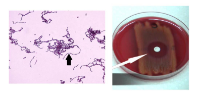 <p>What is/are responsible for the beta-hemolysis produced by this organism? (If there is more than 1 answer, separate answers with a comma then a space. EXAMPLE: Answer 1, Answer 2)</p>