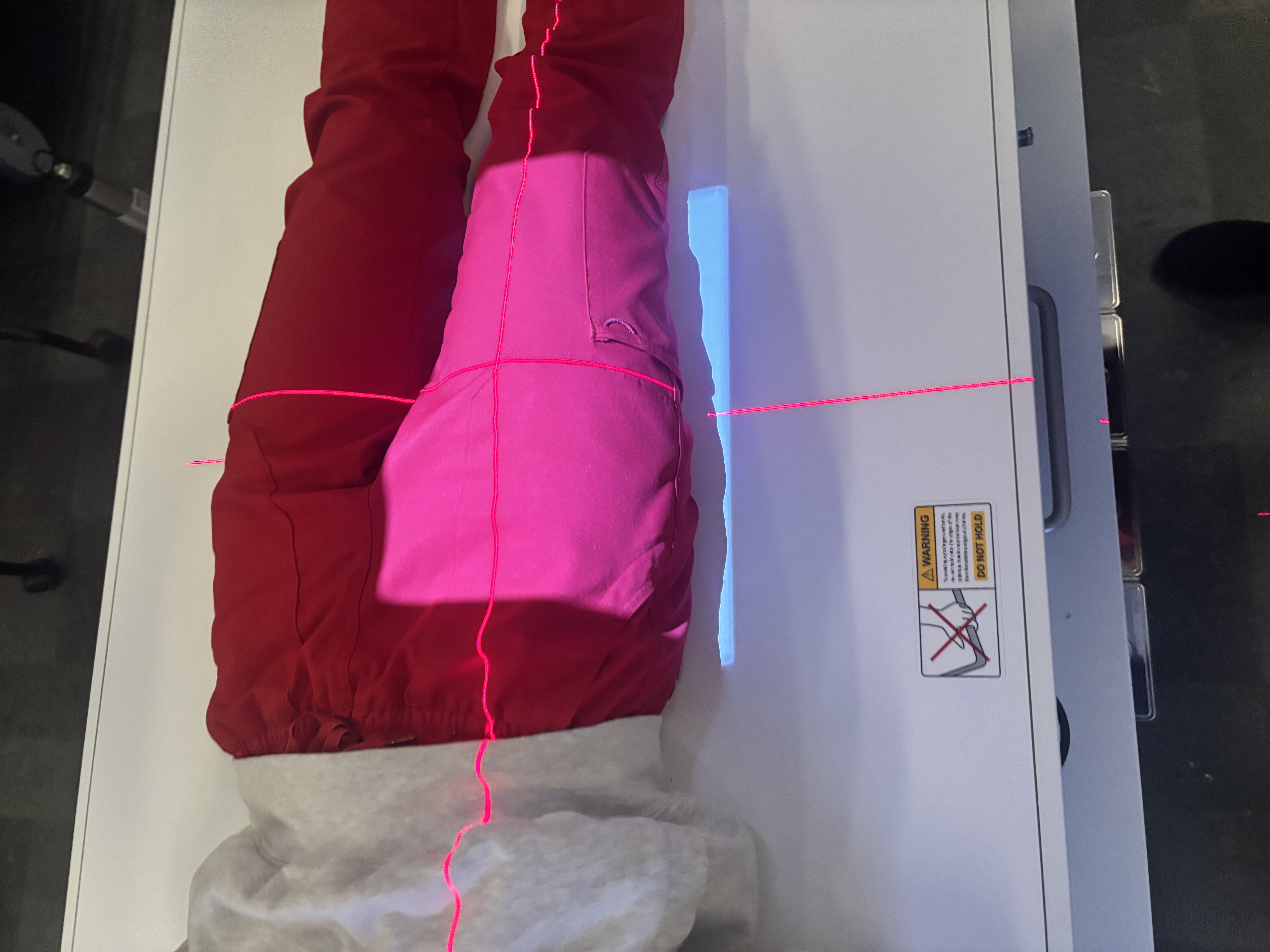 <p>AP Mid &amp; Proximal Femur</p>