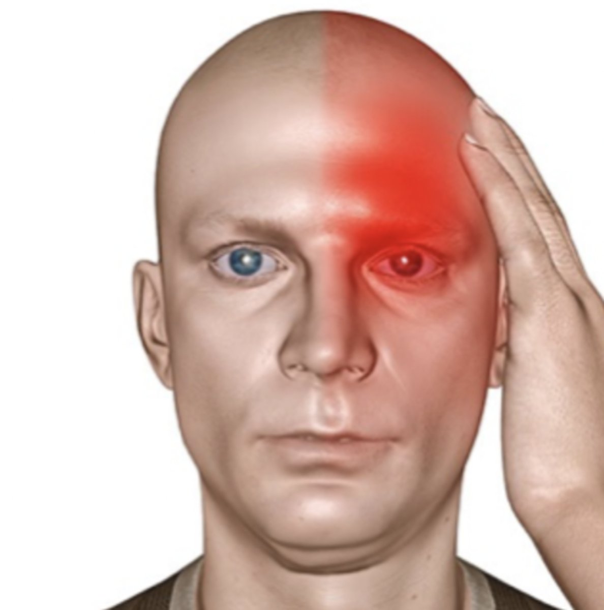 <p>-character = accompanied by nausea, vomiting, and/or sensitivity to noise or light</p><p>-onset = may have prodromal stage (aura), may be precipitated by emotional disturbances, anxiety, ingestion of alcohol, cheese, chocolate, or other foods and substances to which the person is sensitive</p><p>-location = located around the eyes, temples, cheeks, or forehead; may affect only one side of the face</p><p>-duration = aura may last up to 1 hour; headache lasts up to 3 days</p><p>-severity = throbbing, severe</p><p>-pattern = rest, medication may be given daily for prevention and also to abort headache</p><p>-associated factors = occurs more often in women</p>