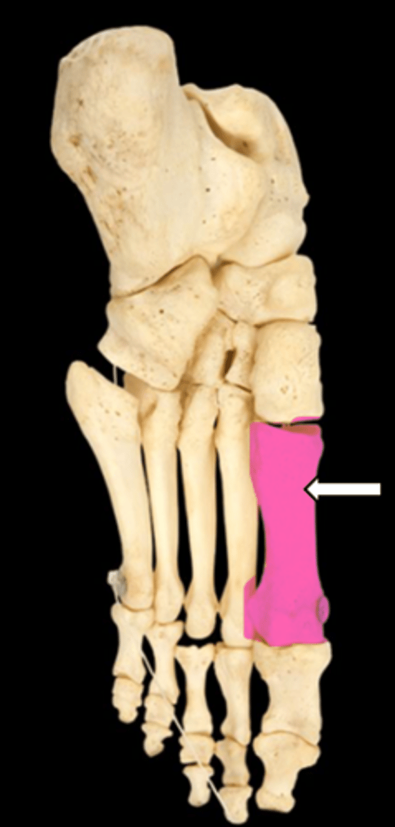 <p>name the part</p>