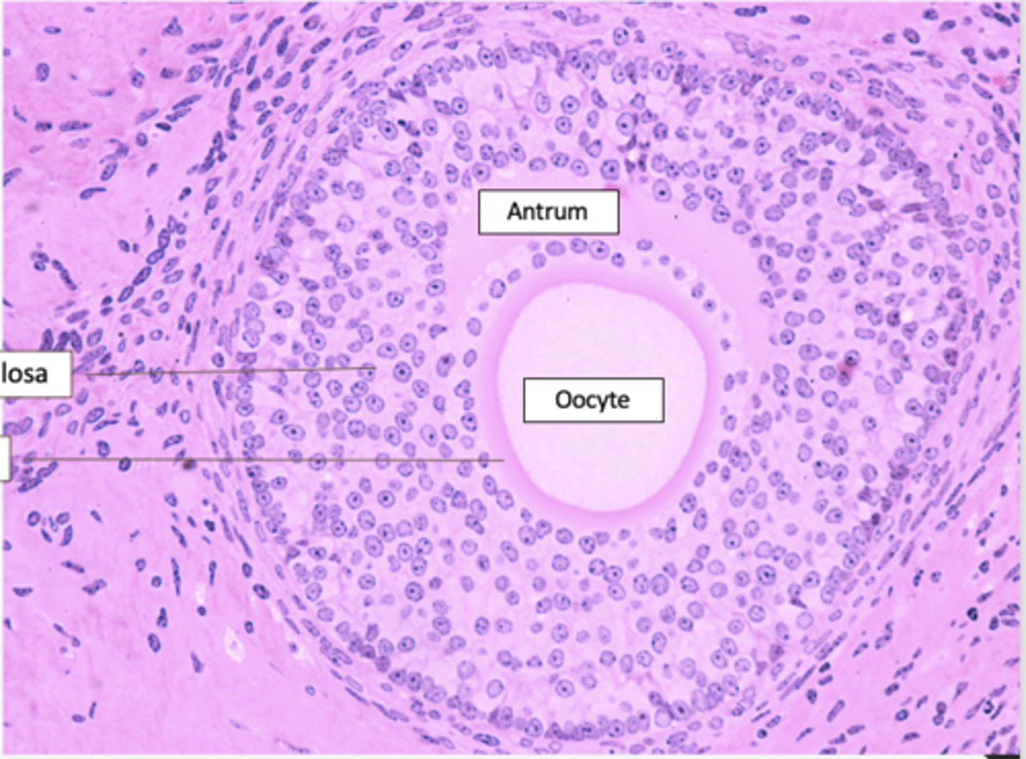 <p>Identify the stage of the follicle</p>
