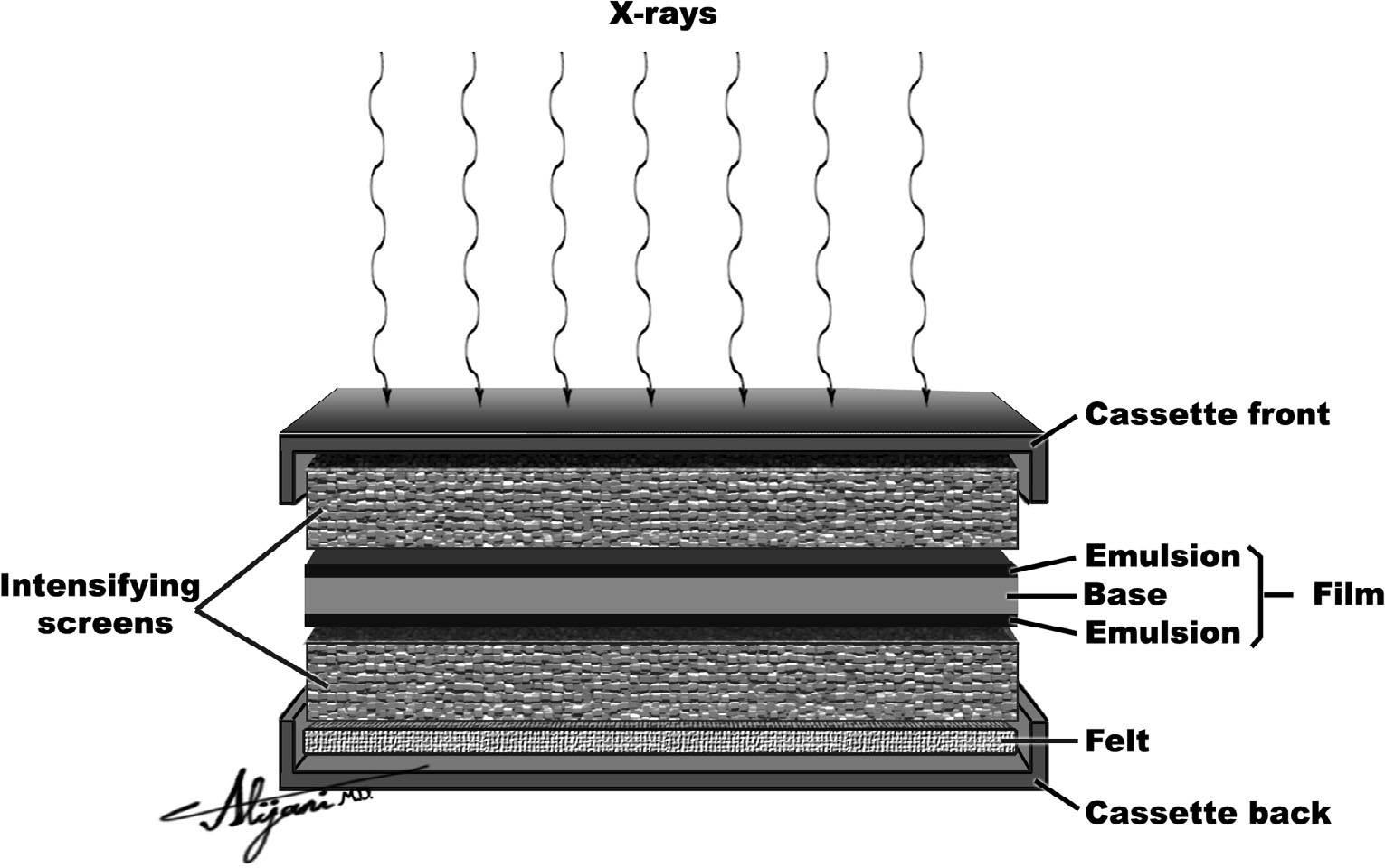 <ul><li><p>need a screen for exposure</p></li><li><p>place between 2 special intensifying screens in a cassette</p></li><li><p>Less radiation required to exposure film </p></li></ul><p></p>