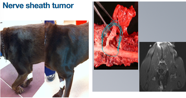 <p>Nerve sheath tumor</p>