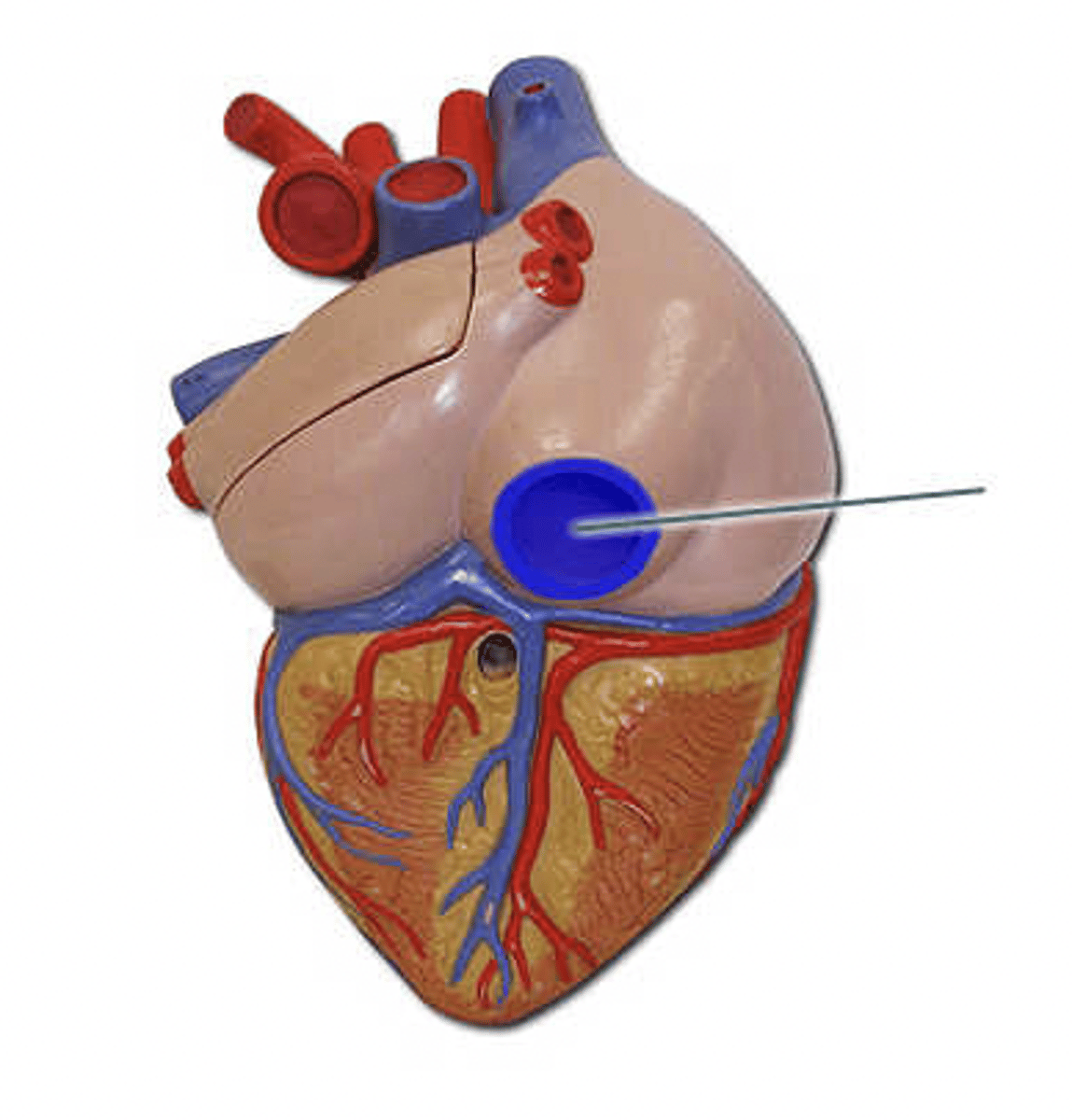 <p>The highlighted vessel (name it) returns blood from the body to which chamber of the heart?</p>