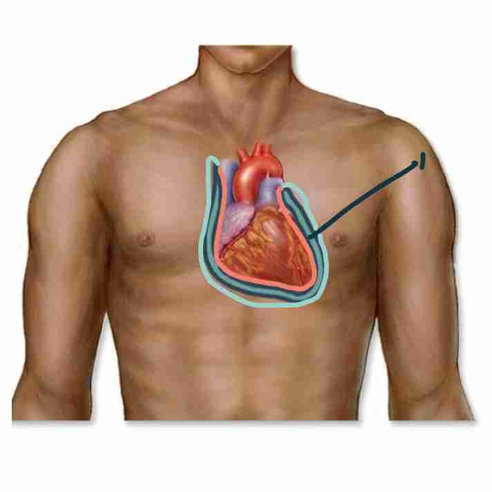 <p>serous membrane holding the heart - 1</p>