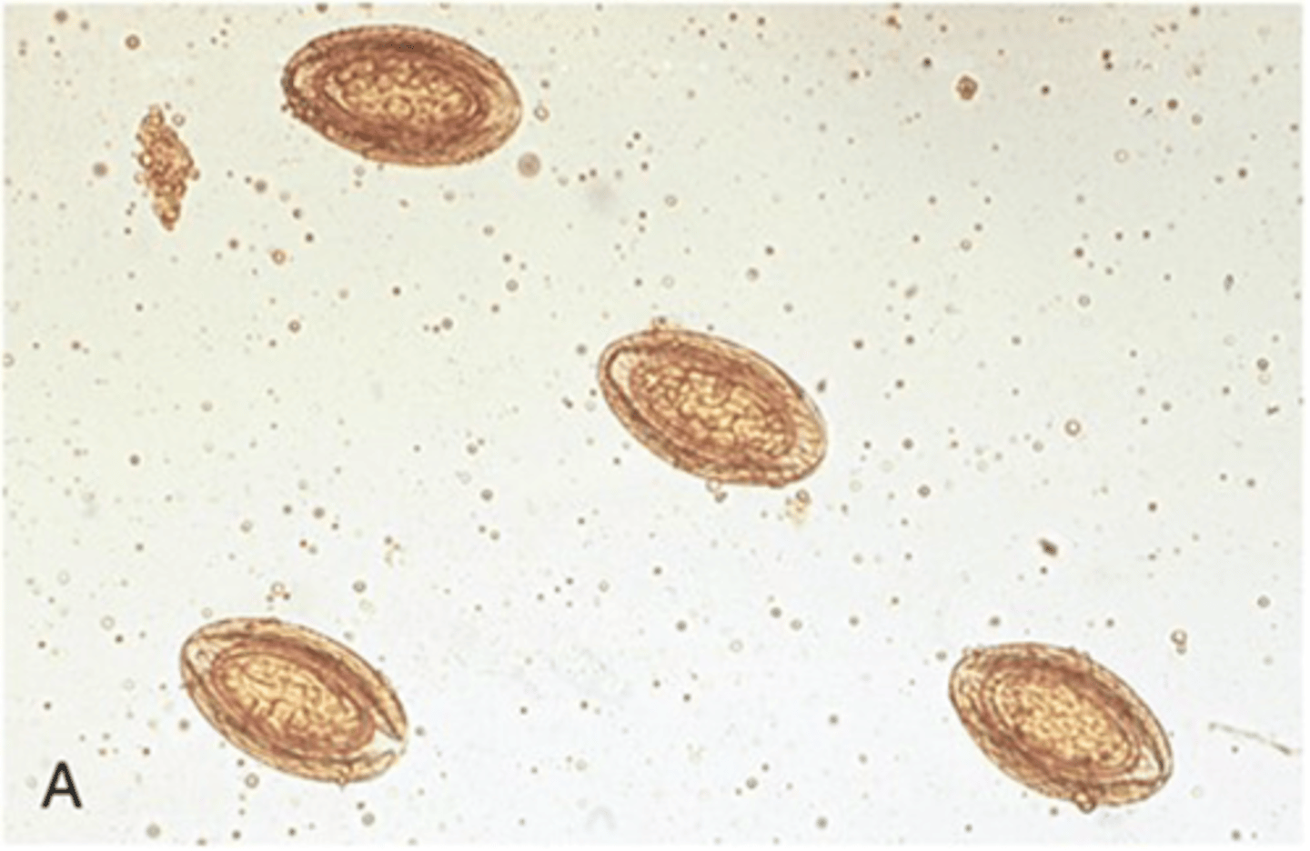 <p>Identify these Acanthocephalan ova of pigs.</p>
