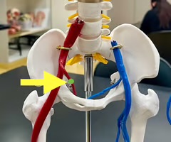 <p>Name the blood vessel.</p>