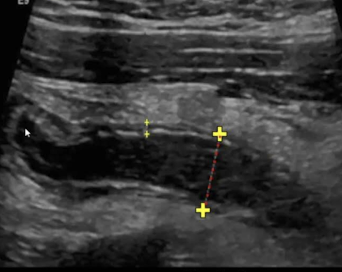 <p>What is this and what type of scan </p>