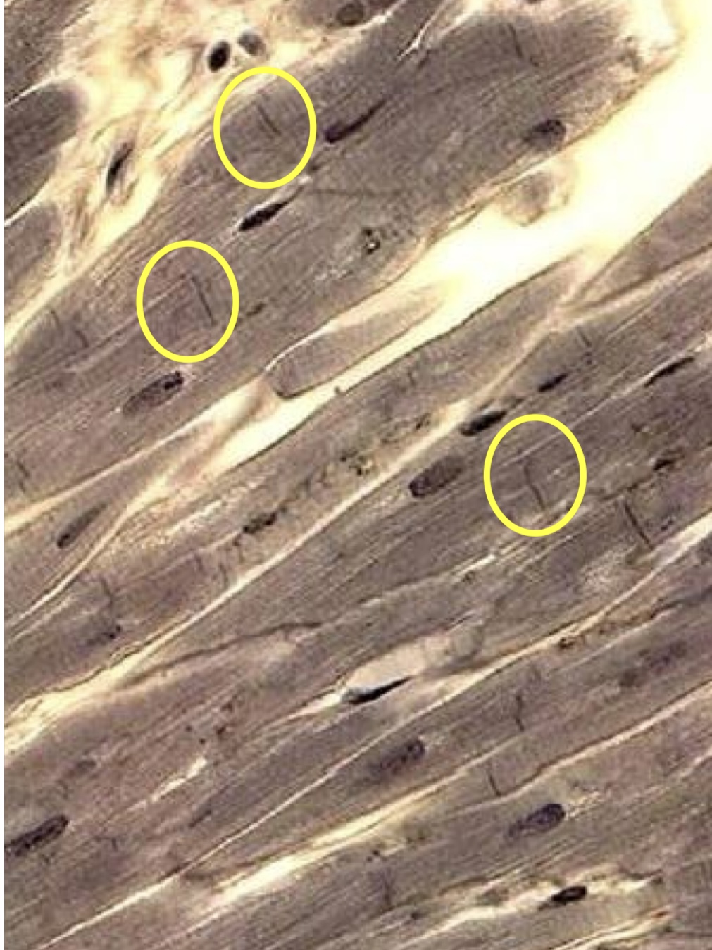 <p>Cardiac muscle </p>