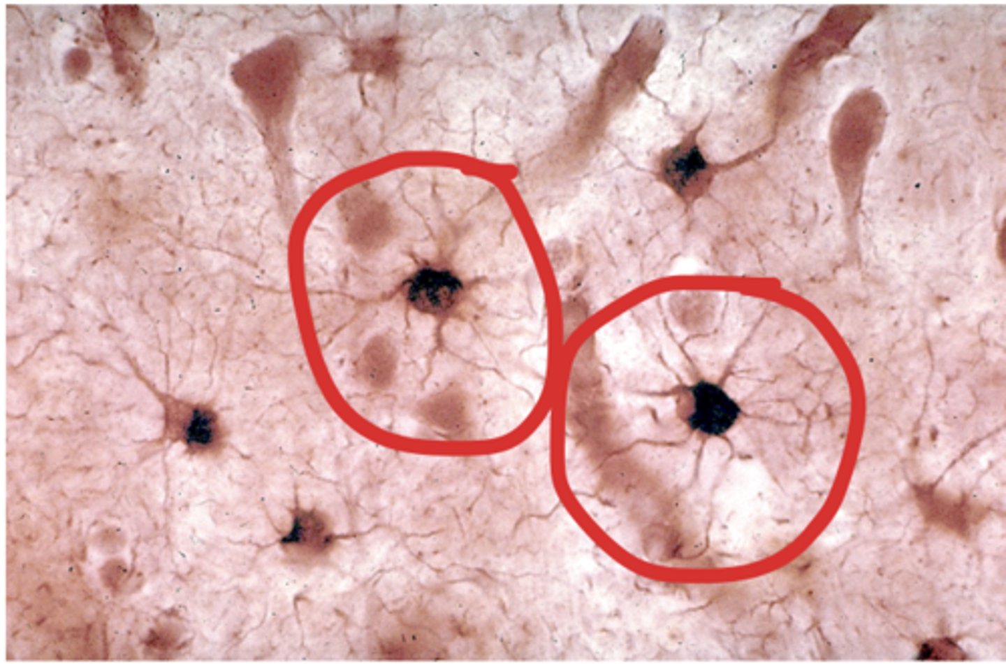 <p>Identify the following neuroglial cells</p>