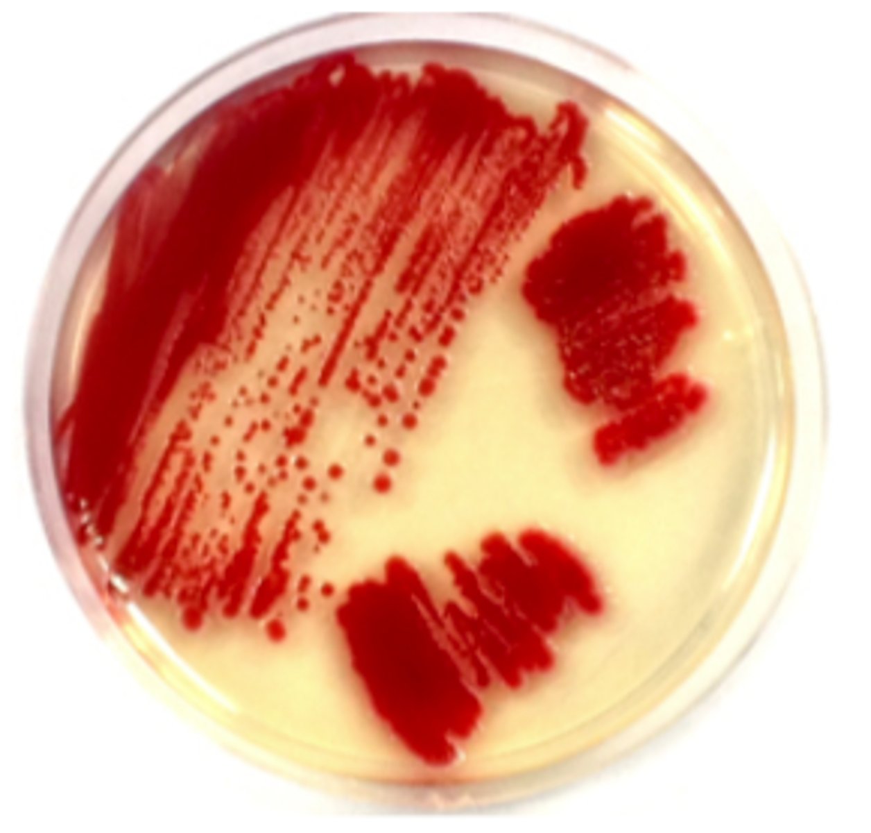 <p>one supplemented with a highly nutritious materials,</p><p>to allow growth of very fastidious microorganisms</p>