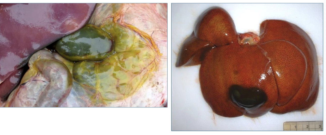 <p>bile imbibition</p>