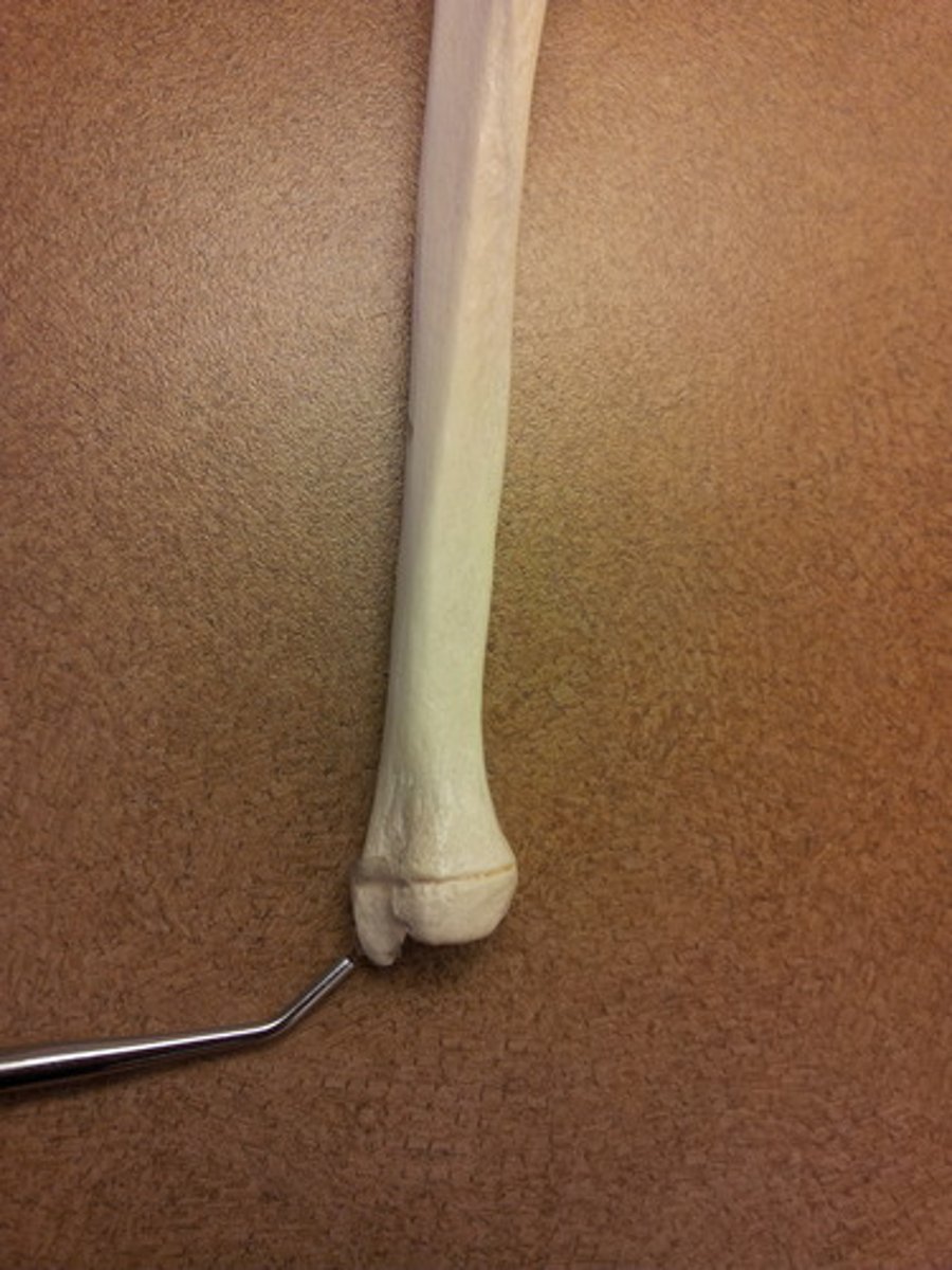 <p>what is this?</p>