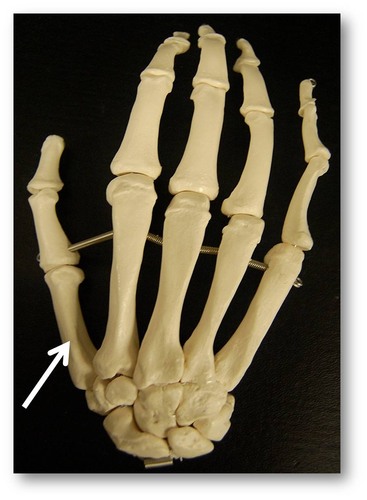 Name this specific bone of the hand (posterior view).