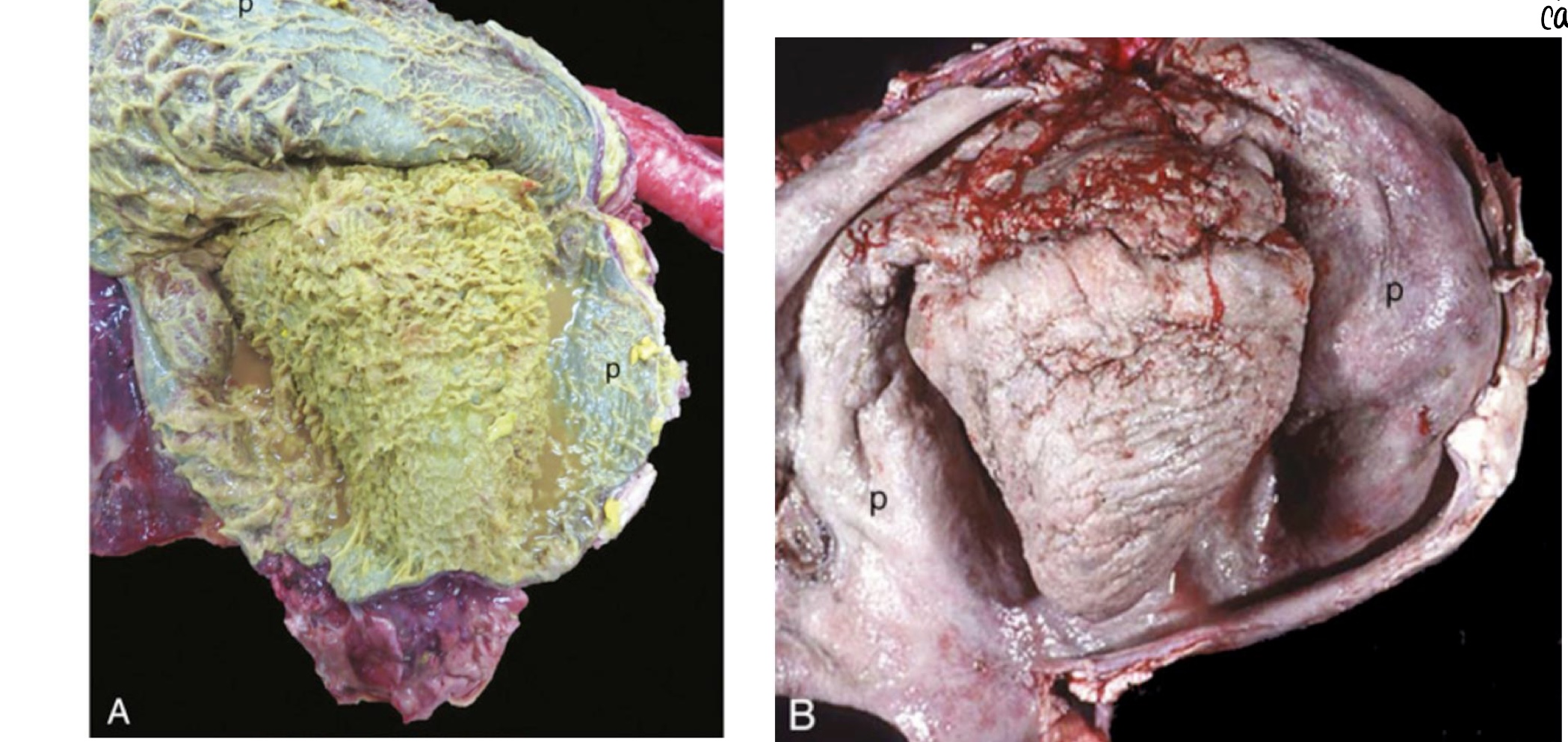 <p>what are these pictures showing?</p>