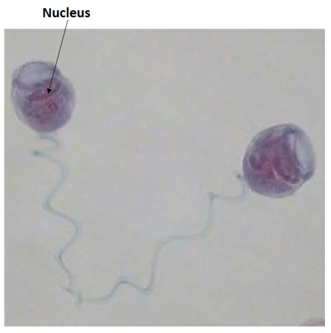 <p>Uses cilia for movement</p>