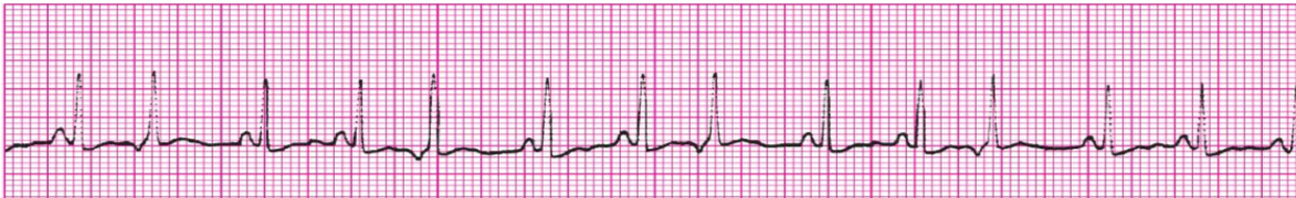 <p>What’s the rhythm?</p>