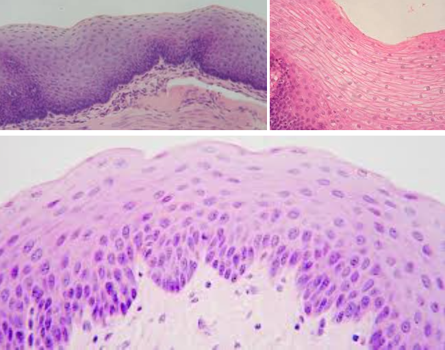 <ul><li><p>Characteristic:<strong> MULTIPLE LAYERS OF SQUAMOUS CELLS</strong></p><ul><li><p>It’s <strong>FLAT WITH A LOT OF LAYERS</strong></p></li></ul></li><li><p>Location: <strong>EPIDERMIS OF <em><u>SKIN</u></em> and LINING OF MOUTH</strong></p></li><li><p>Function: <strong>PROTECTION</strong></p></li></ul><p></p>