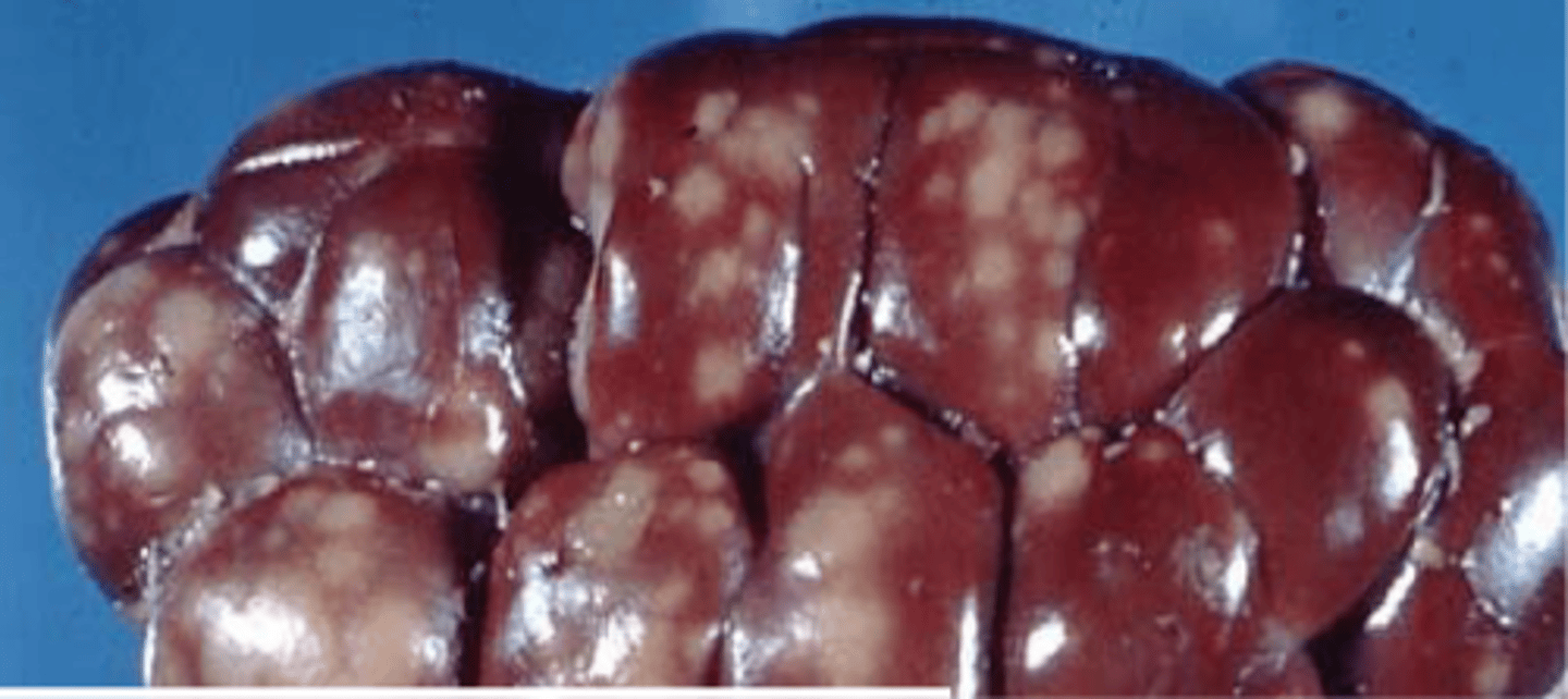 <p>White Spotted Kidney Disease</p>