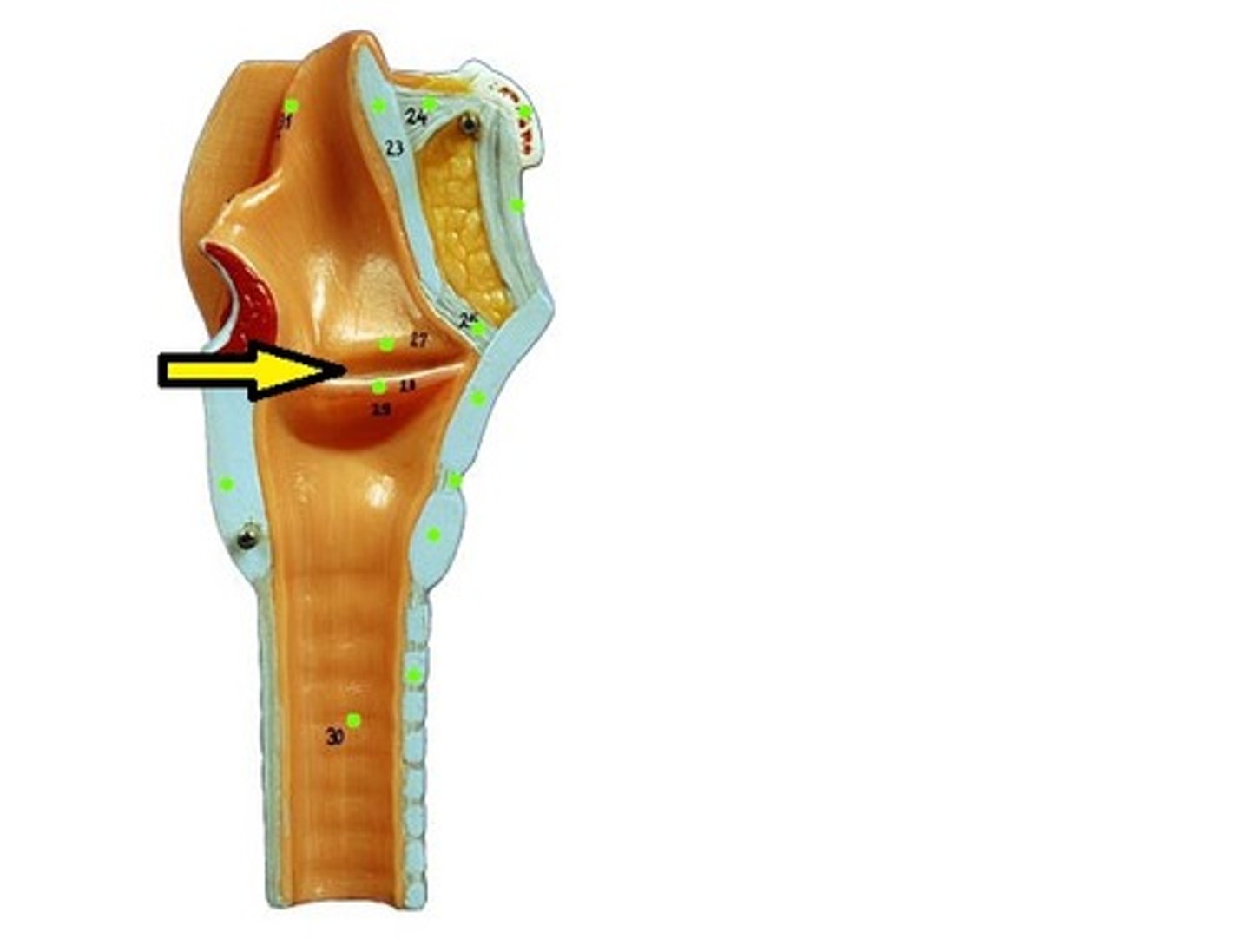 <p>The entry point into the larynx</p>