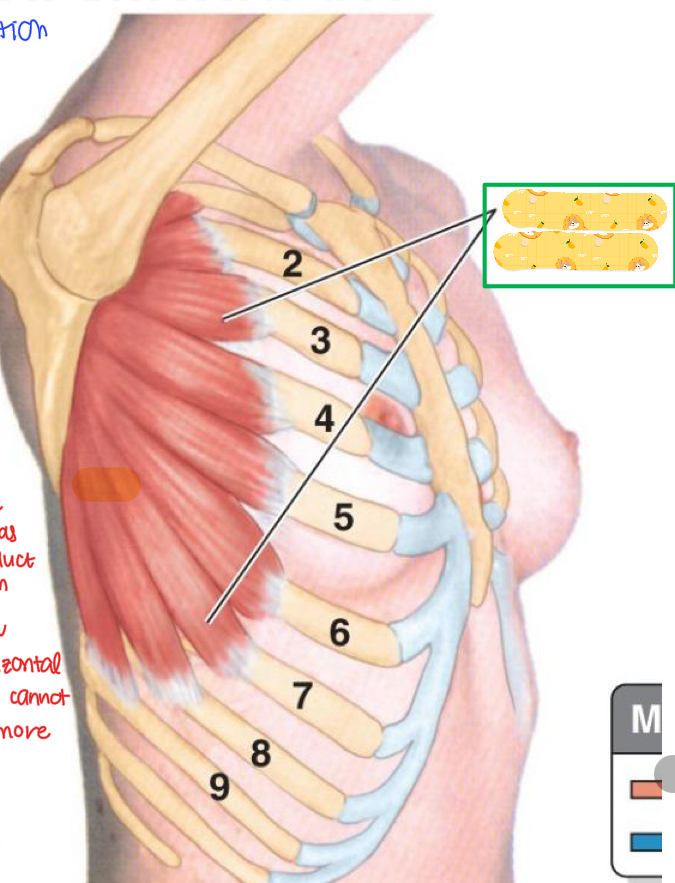 <p>Name this muscle</p>