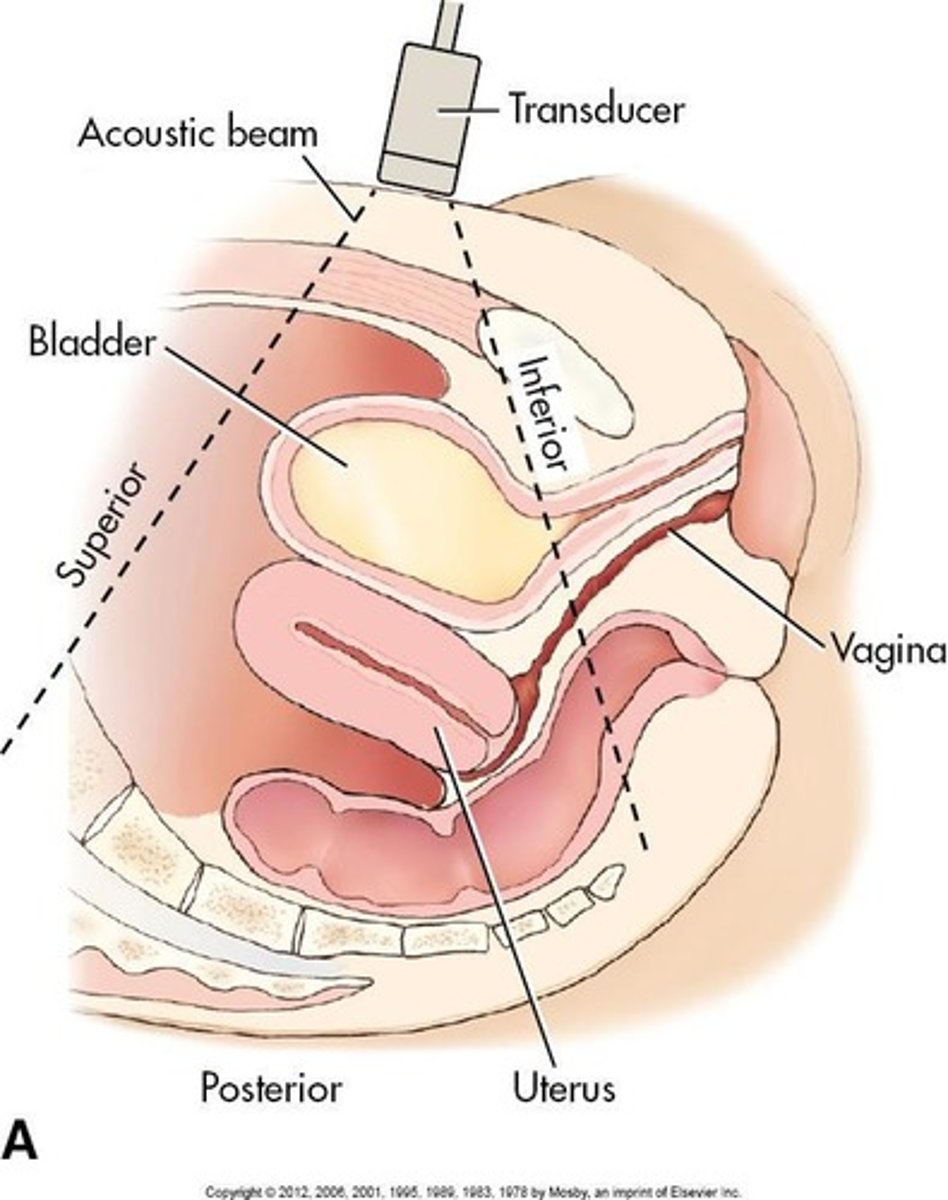 <p>Internal ultrasound examination via the vagina.</p>