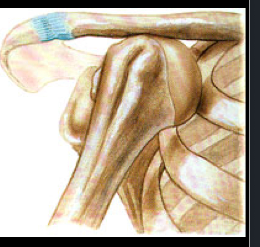<p>What is the clinical diagnosis of this dislocation?</p>