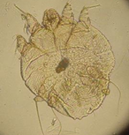 <p>What Parasite Is This?</p>