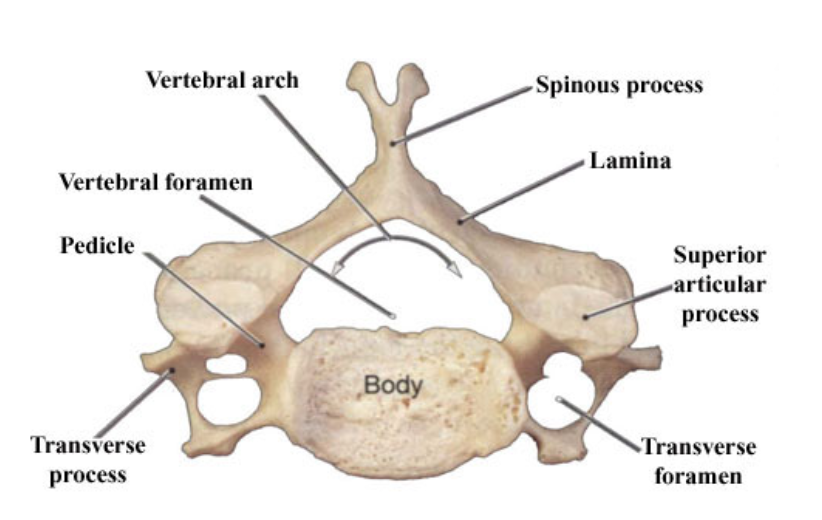 <p>Specimen A is a/an ____ vertebrae. </p><p></p><p>A. cervical</p><p>B. thoracic</p><p>C. lumbar</p><p>D. atlas</p>