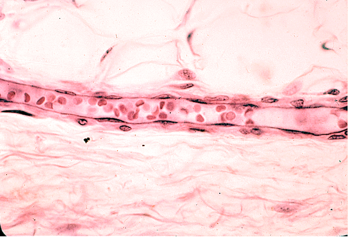 <p><strong>Venule </strong>because:</p><ul><li><p><strong>Larger lumen</strong> than a capillary but still relatively small.</p></li><li><p><strong>Thin wall</strong> with a single layer of endothelial cells and some surrounding connective tissue.</p></li><li><p><strong>No thick tunica media</strong> (unlike arteries).</p></li><li><p><strong>More nuclei</strong> than typically seen in a capillary, indicating a slightly larger vessel.</p></li></ul><p></p>