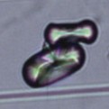 <p>Found in synovial fluid</p><p>Oval or dumbell shaped crystal</p>