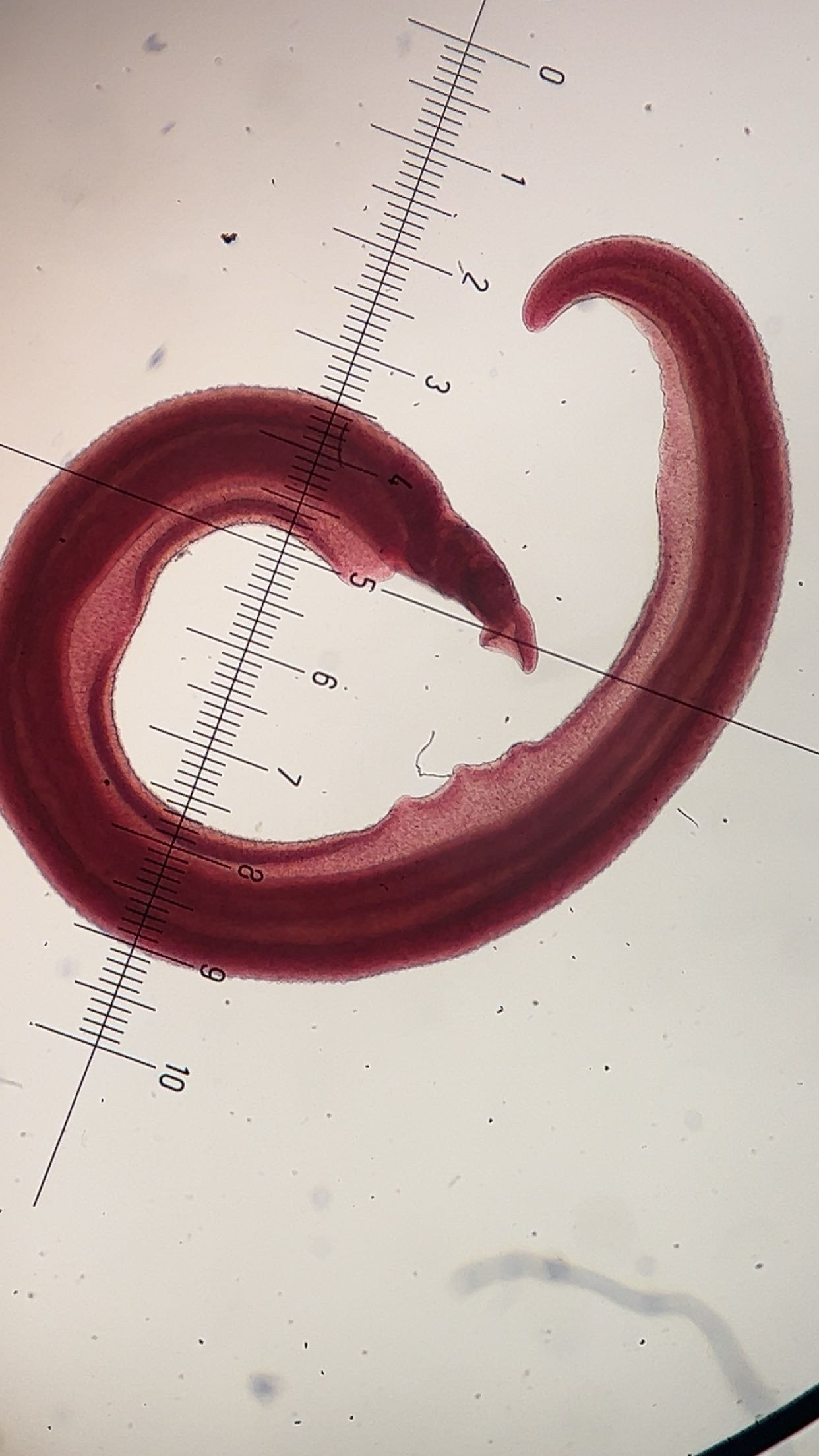 <p><em><span>Schistosoma mansoni</span></em><span> adult male</span></p>