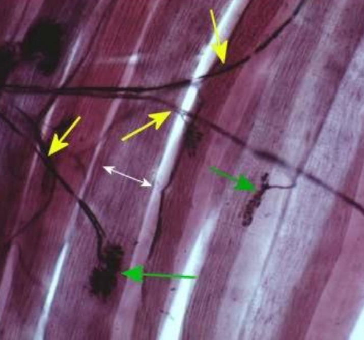 <p>What are the GREEN arrows pointing to?</p>