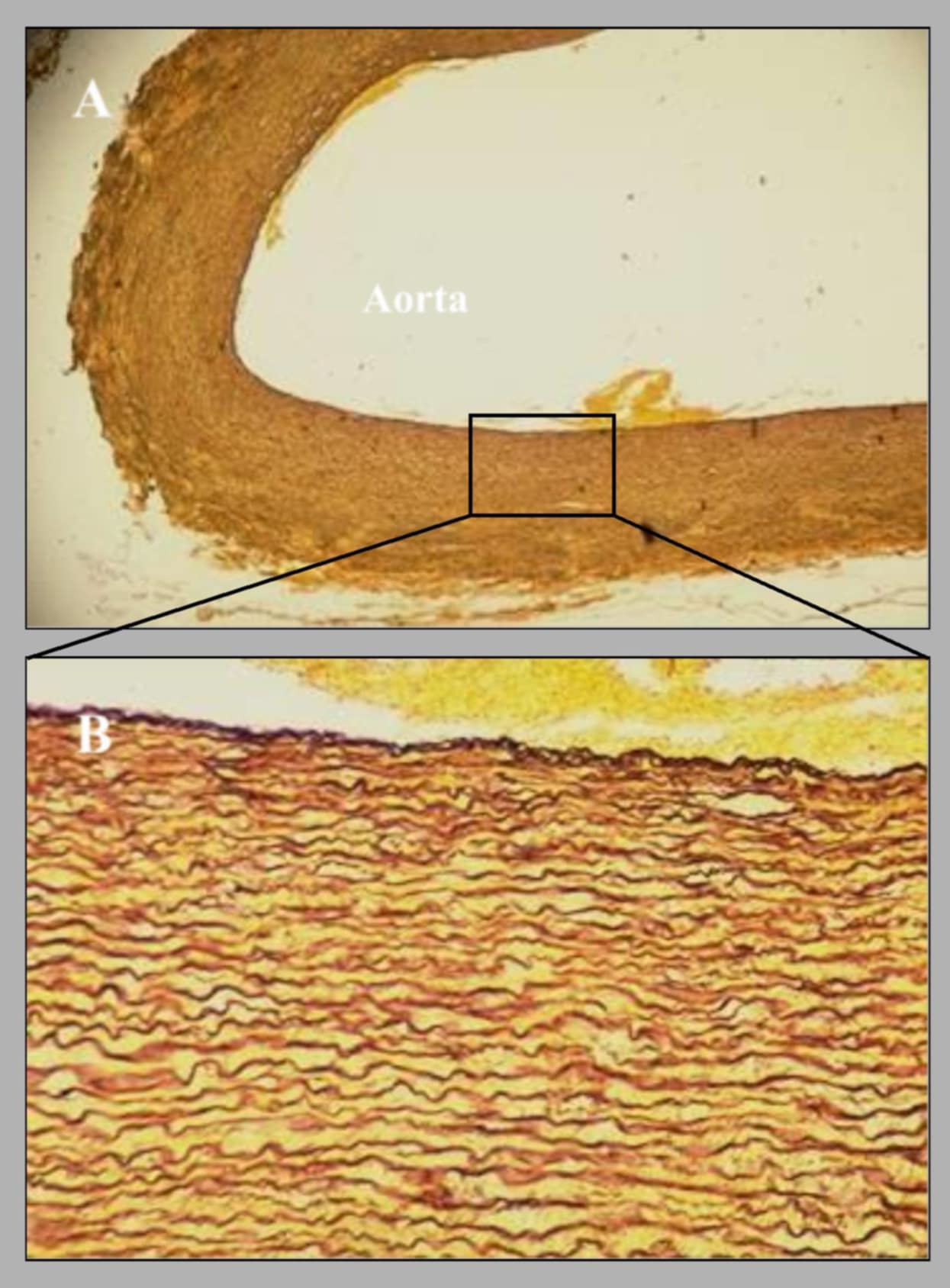 <p>wall of aorta, canine, elastic fiber stain. this cross section of the aorta was stained with ______ to demonstrate the presence of elastic fibers.</p>