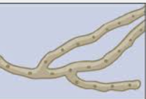 <p>Nonseptate hyphae</p>