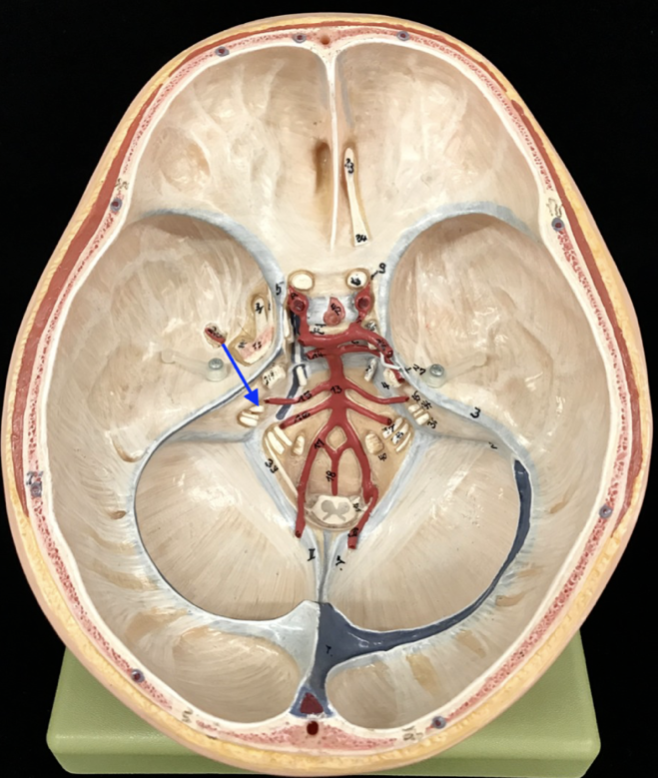 <p>What is the cranial nerve and roman numeral?</p>