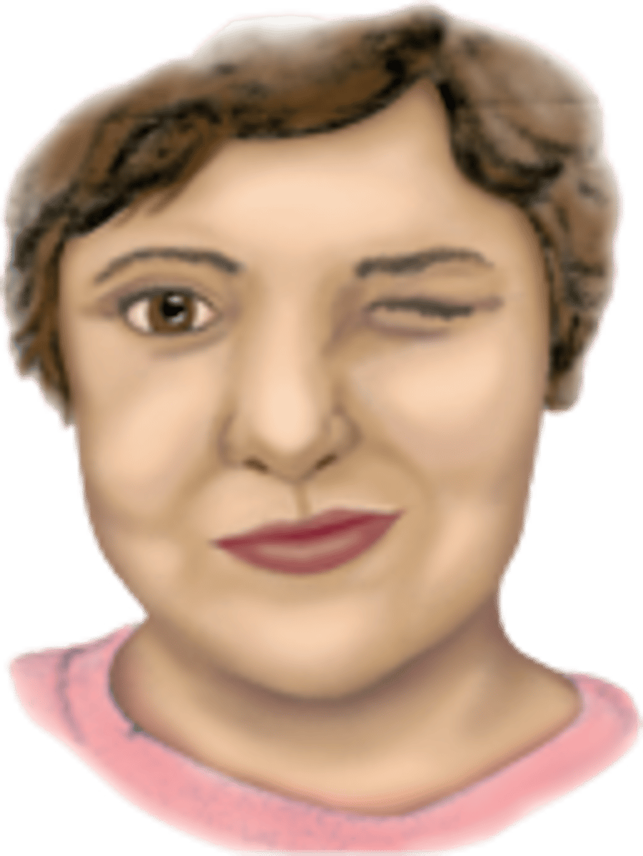 <p>Tics are brief, repetitive, stereotyped, coordinated movements occurring at irregular intervals. Examples include repetitive winking, grimacing, and shoulder shrugging. Causes include Tourette's syndrome and drugs such as phenothiazines and</p><p>amphetamines.</p>