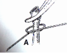 <p>What type of ligature does this image show?</p>