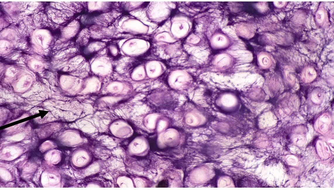 <p>Identify the type of tissue and the<br>structure at the arrow</p>