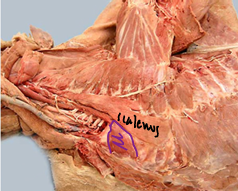 <p>Thoracic wall</p>