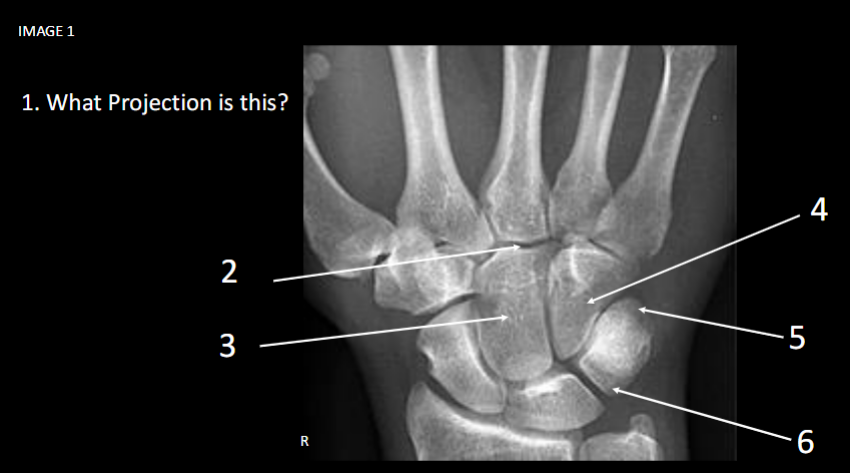 <p>What is number 4</p>